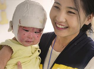Un viaje maravilloso para pacientes con quemaduras en Mongolia